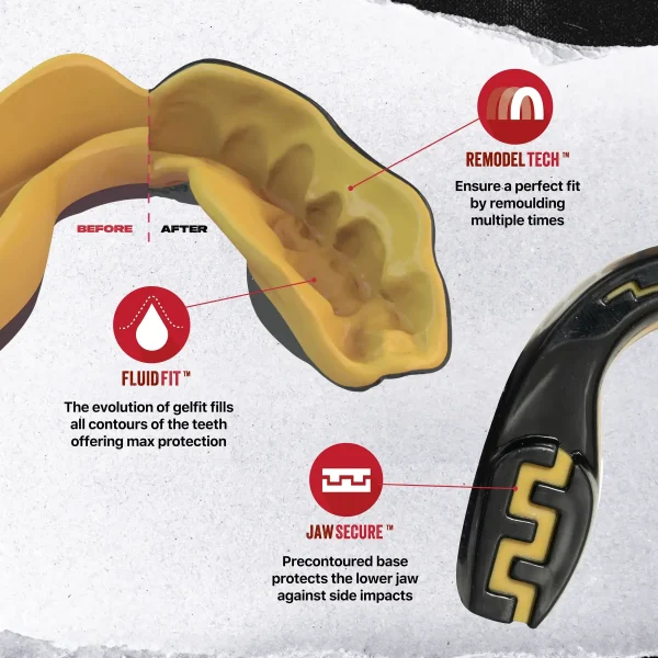 Safejawz Extro Series Goldie Mouth Guard Black Gold 1 Image of the Safejawz Extro Series Goldie Mouth Guard providing ultimate teeth protection for sports