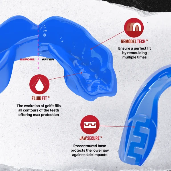 Safejawz Extro Series Ice Mouth Guard Blue 1 Close-up image of the Safejawz Extro Series Ice Mouth Guard on a clean, white background.