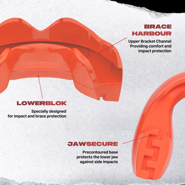 Safejawz Ortho Series Mouthguard For Braces Red 3 Image of Safejawz Ortho Series Mouthguard for Braces