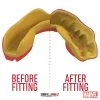 Sport participant wearing the Safejawz x Marvel Iron-man Mouthguard for teeth protection during games.
