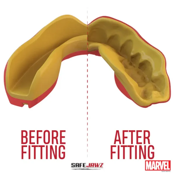 Sport participant wearing the Safejawz x Marvel Iron-man Mouthguard for teeth protection during games.