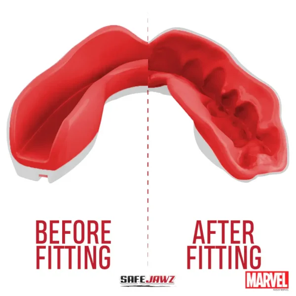 Safejawz X Marvel Logo Mouthguard White 6 Image of Safejawz x Marvel Logo Mouthguard