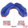 Safejawz x Marvel Ortho Spider-Man Mouthguard, a protection for the mouth in sports