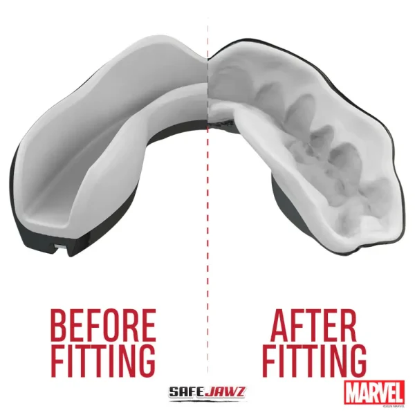 Picture of Safejawz x Marvel Ortho Venom Mouthguard on a white background.